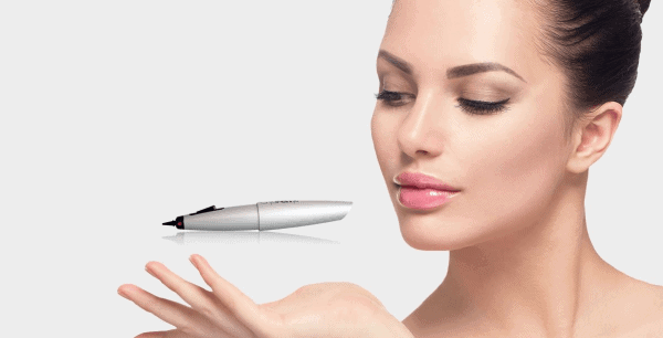 CryoPen Cryotherapy Golders Green