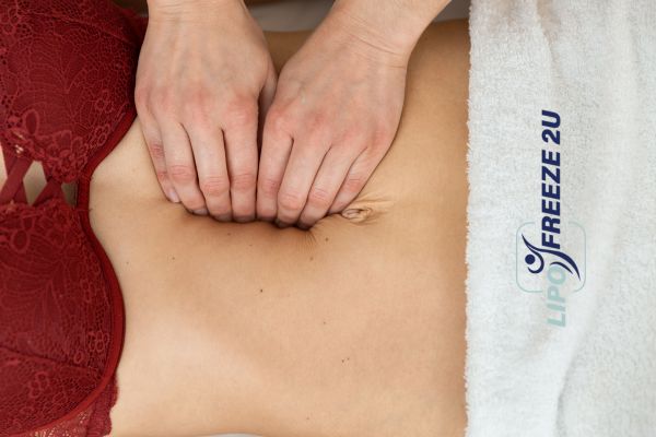 diastasis recti treatment Golders Green