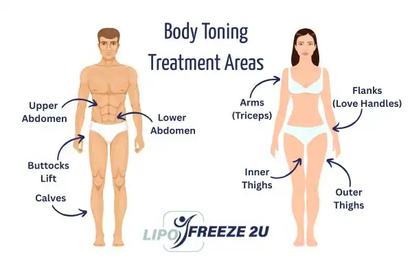 Graphic showing where you can have Body toning Treatment Golders Green on your body