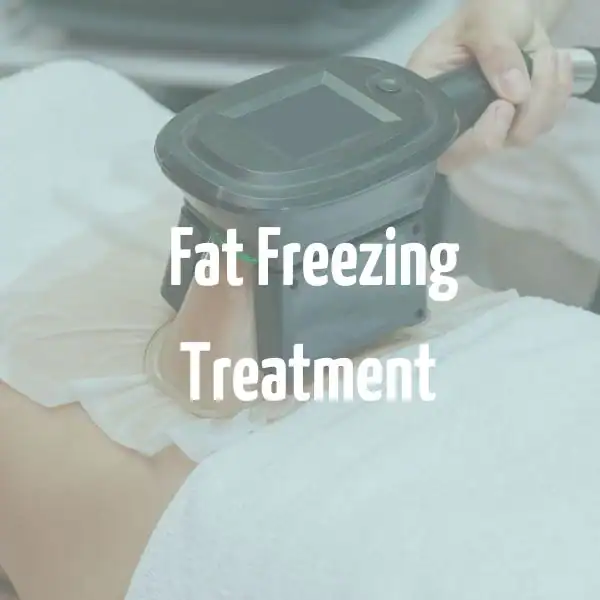 fat freezing treatment Golders Green